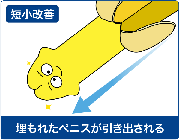 短小ペニスの解消イメージ