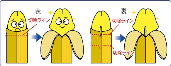 傷跡が目立ちにくい自然な仕上がり