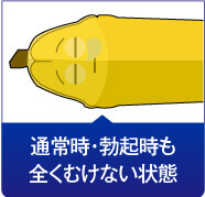 通常時・勃起時も全くむけない状態