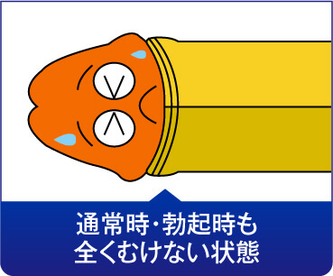 締め付けがきつくて皮がむけない状態