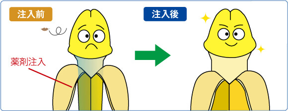 陰茎増大術:薬剤注入前・注入後