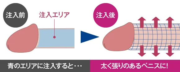 陰茎増大術施術後イメージ：大きくバランスのいい見た目に