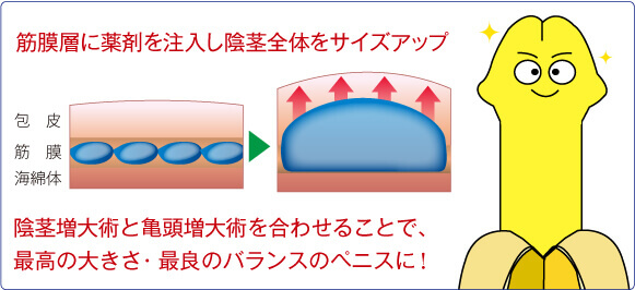 選べる施術法:薬剤注入法