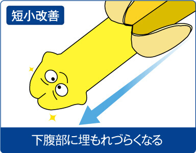 短小ペニスの改善イメージ