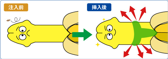 陰茎増大:シリコン挿入前→挿入後