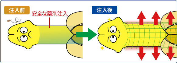 陰茎増大:薬剤注入前→注入後