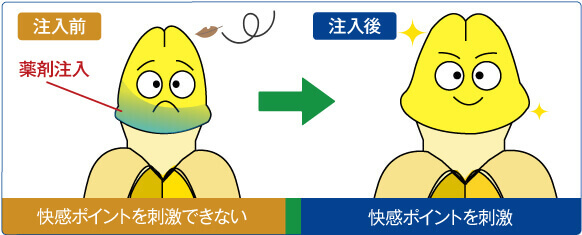 亀頭増大術施術後イメージ:大きくバランスのいい見た目に