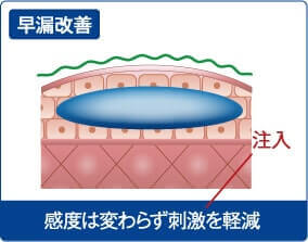 早漏改善・感度は変わらず刺激を軽減