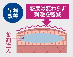 早漏改善・感度は変わらず刺激を軽減