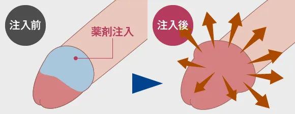 全体注入法：薬剤注入前→注入後