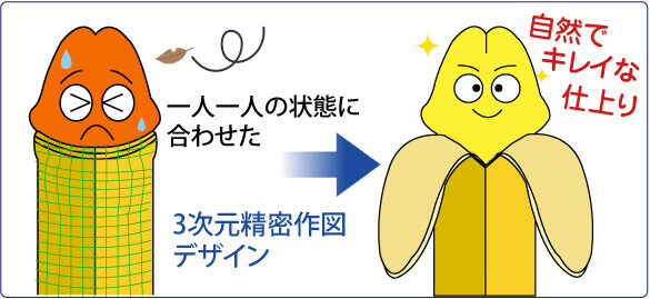 包茎 手術 カントン