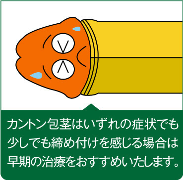 カントン包茎はいずれの症状でも少しでも締め付けを感じる場合は早期の治療をおすすめいたします。