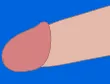 ペニス長茎術のイラスト